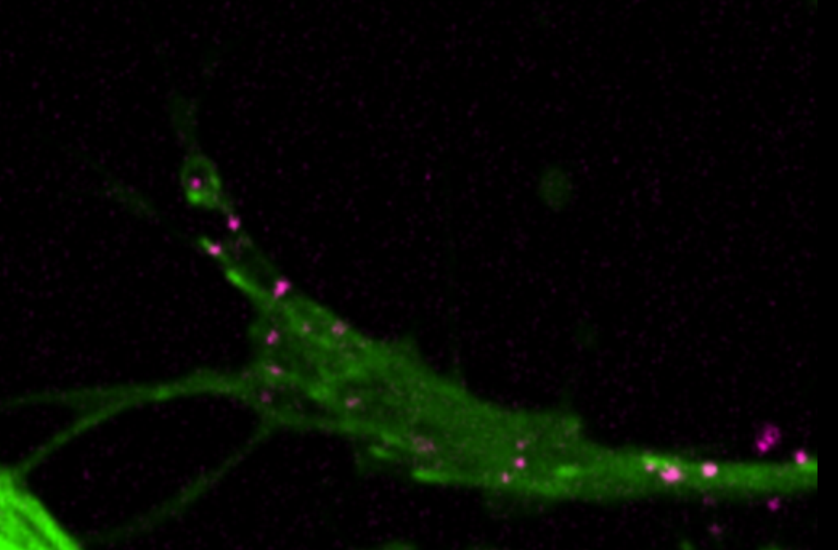 Time-lapse movie showing beta-actin mRNA granules (pink) moving inside the growth cone of a retinal axon. The granules can be seen making excursions into the long thin filopodia, often in association with dynamic microtubules (green). (Movie made by Trina Bo Lu).'s image