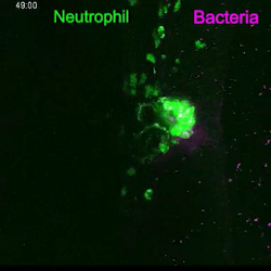 GFP-marked leukocytes (green) moving towards a site where DsRed-marked bacteria (red) have been injected.'s image